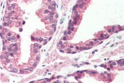 Immunohistochemistry-Paraffin: VIGR/GPR126 Antibody [NBP3-14378]